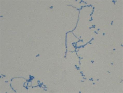 Whitish Chalky Colonies Of N Paucivorans Yielded On Blood Agar