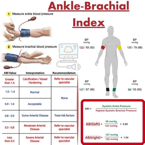 The Ankle Brachial Index Test For Peripheral Artery Disease