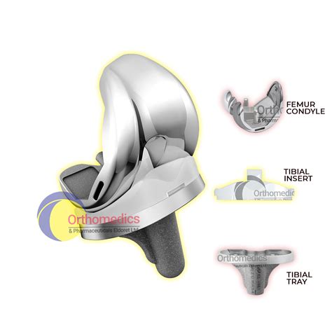 Total Knee Replacement Orthomedics And Pharmaceuticals Ltd