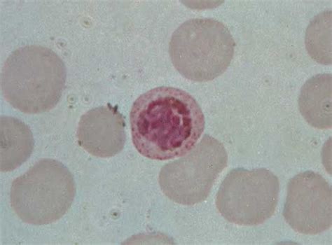 Plasmodium Vivax Organism Britannica