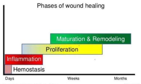 Wound And Wound Healing Flashcards Quizlet