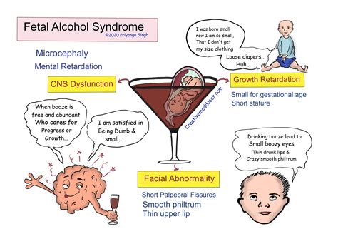 Adults With Fetal Alcohol Syndrome