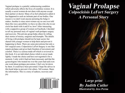 Vaginal Prolapse Colpocleisis Surgery - A Personal Story Book and Video