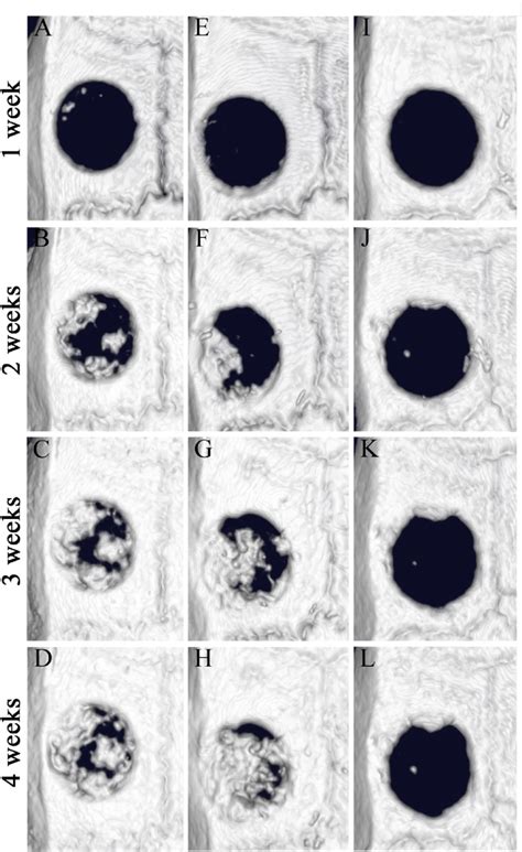 Axial Volume Rendered Images Within The Calvaria Bone Defects Obtained