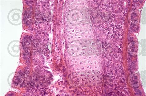 Rat Lung Transverse Section X Rat Mammals Respiratory