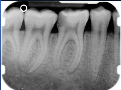 Radiography Techniques Flashcards Quizlet