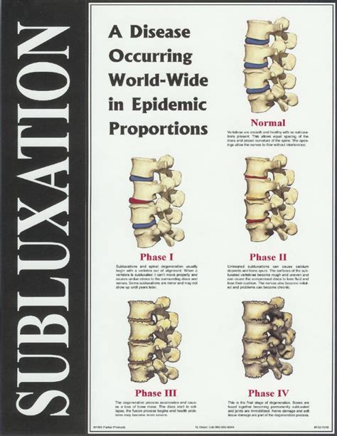 What Is A Subluxation Oakville Chiropractic Centre