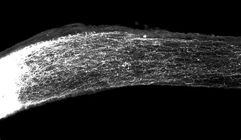 Gene jumpstarts regeneration of damaged nerve cells