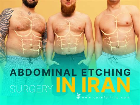 Abdominal Etching Surgery In Iran CarefulTrip