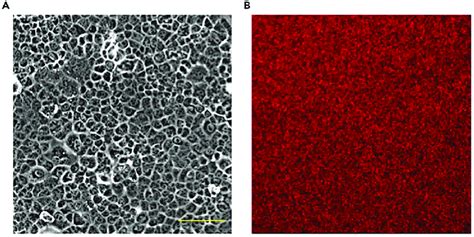 Confluent Monolayer Of Aml Cells On Pdms Substrate Representative