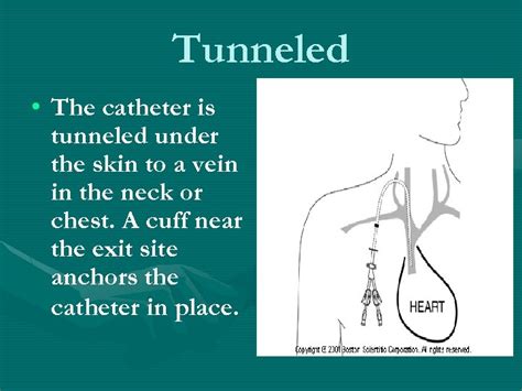 Venous Access Devices In Clinical Practice An Overview