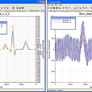 Testing with a normal ECG wave | Download Scientific Diagram