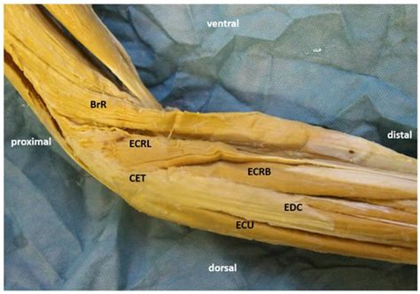 Applied Sciences Free Full Text Ultrasound Guided Procedures In Common Tendinopathies At The