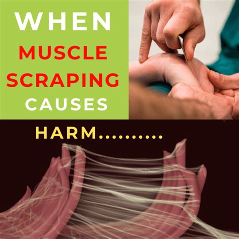 When Muscle Scraping Causes Harm