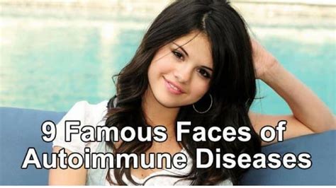 Nine Celebrities With Chronic Illnesses Mckoysnews