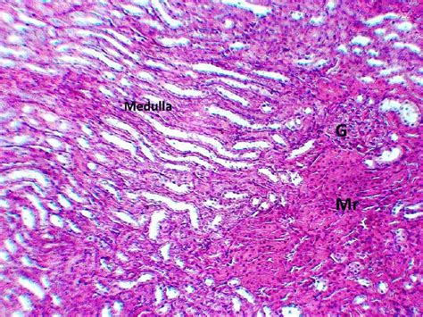 Renal Histology