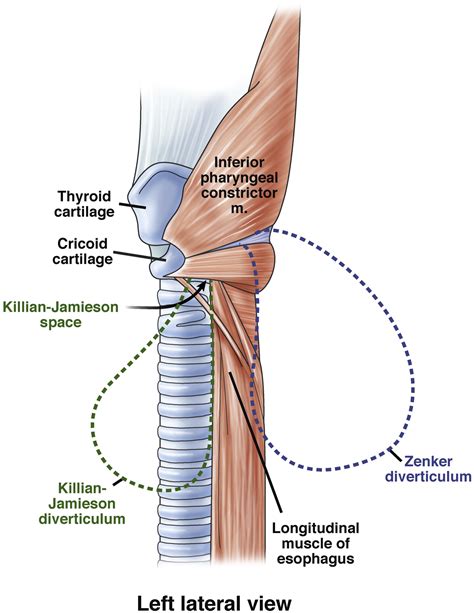 Zenker S Diverticulum Clinical Gastroenterology And Hepatology