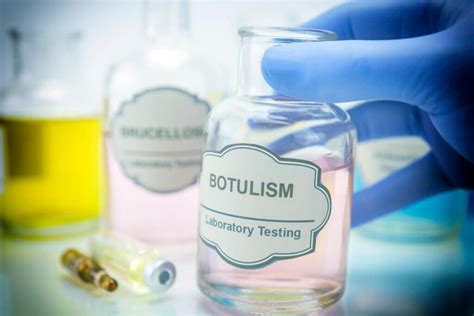 Botulism: symptoms, causes and treatment