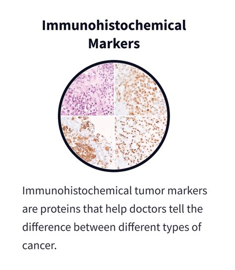 Mesothelioma Immunohistochemistry: Diagnosis & Mesothelioma IHC Markers