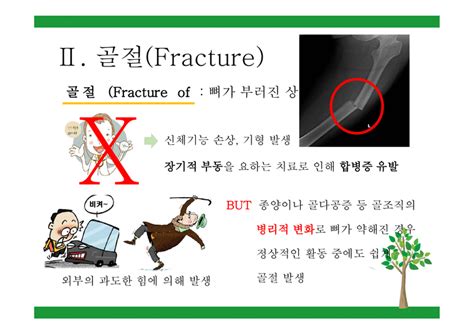 골절 병태생리 분류 치유과정 진단검사 의약학