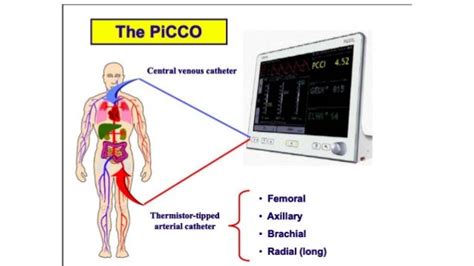 PiCCO Monitor