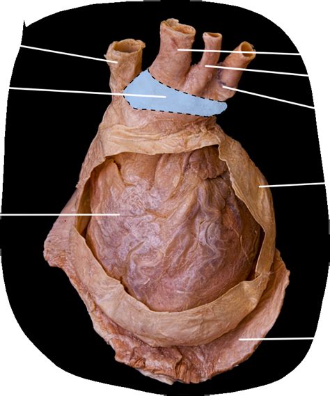 Heart In Fibrous Pericardium Diagram Quizlet