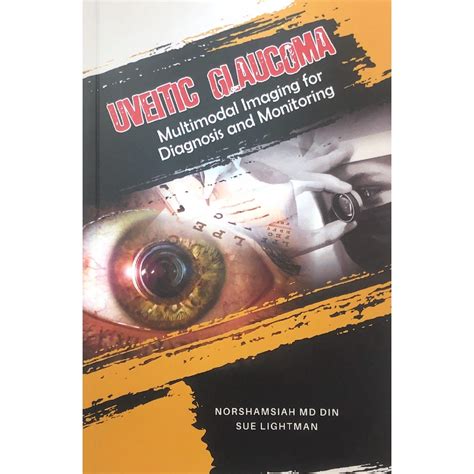 Uveitic Glaucoma: Multimodal Imaging for Diagnosis and Monitoring | Shopee Malaysia