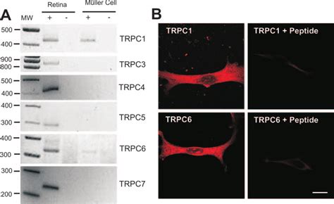 TRPC mRNA and protein in mouse Müller cells mRNA from mouse retina or