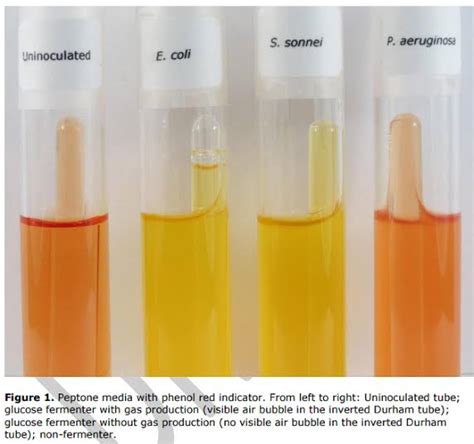 Phenol Red Fermentation Test Principle Procedure Uses And