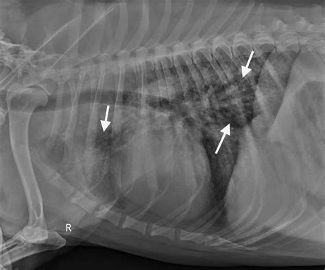 Image Gallery Primary Metastatic Tumors Part Clinician S Brief