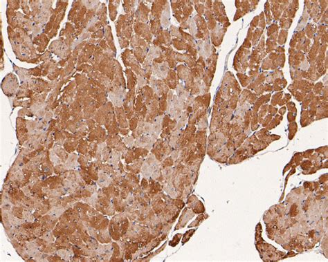 Phospholamban Polyclonal Antibody Pa5 119803