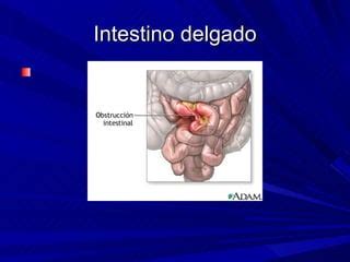 Tumores Y C C3 A1ncer De Intestino Delgado 2 PPT