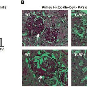 Pristane induced glomerulonephritis in wild type WT and TLR 7 Ϫ Ϫ