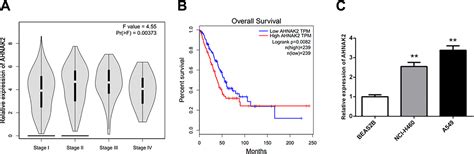 Down Regulation Of AHNAK2 Inhibits Cell Proliferation Migration And