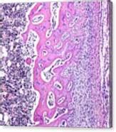 Endochondral Ossification Photograph By Jose Calvo Science Photo