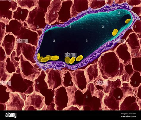 Coloured Scanning Electron Micrograph Sem Of Photocomposite Of