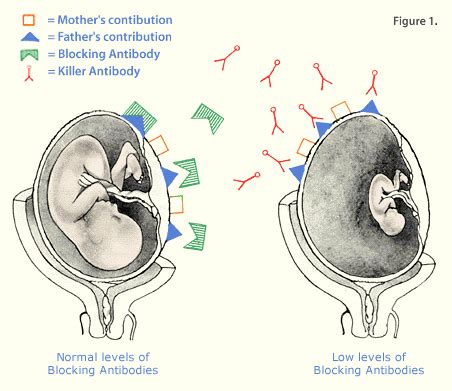 Reasons For Single And Recurrent Miscarriages Ria Labs