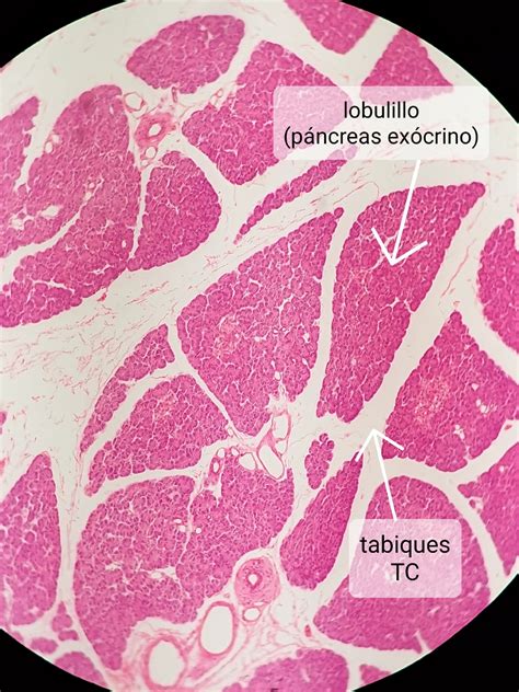 Tp 20 Histología Del Aparato Digestivo Hígado Páncreas Vesícula