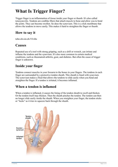 Text What Is Trigger Finger HealthClips Online