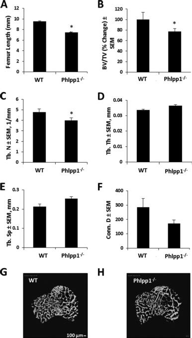 Deletion Of The Ph Domain And Leucine Rich Repeat Protein Phosphatase