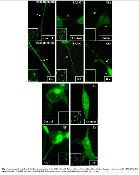 Effects Of All Trans Retinoic Acid On Human Sh Sy5y Neuroblastoma As In