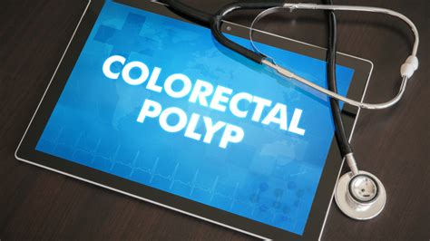 Why It Is Essential To Remove Colon Polyps - CancerMitr