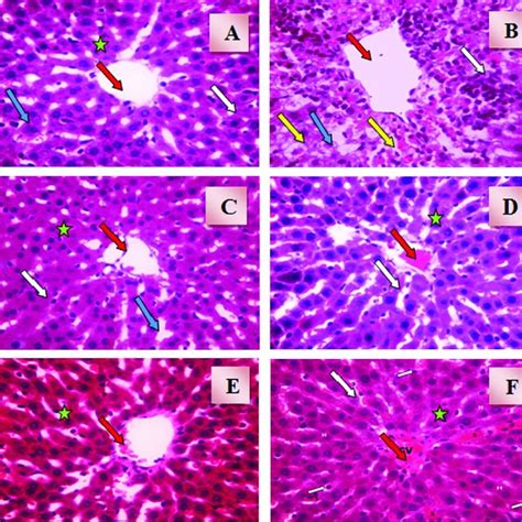 A A Photomicrograph Of Liver Section Obtained From Control Rats H E