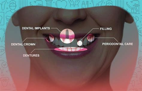 Rotary Endodontics In Hyderabad Mastership In Restorative Dentistry