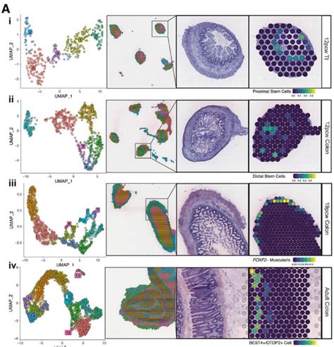 Spatial Transcriptomics Publications Youll Want To Read X Genomics