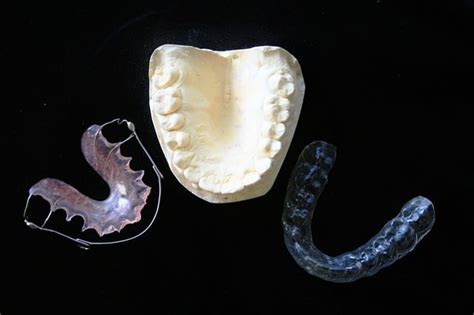 The Importance Of Wearing Retainers After Treatment Tisseront