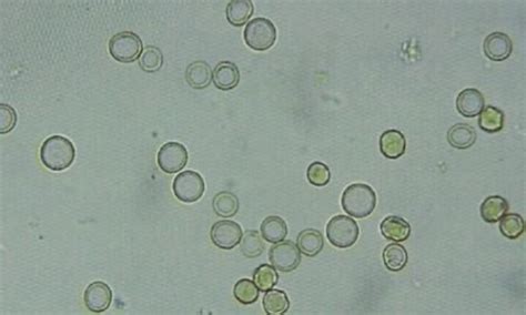 Flashcards MICROSCOPIC URINALYSIS Quizlet