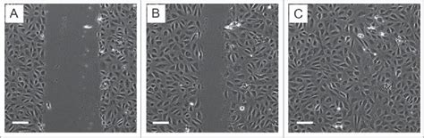 An Introduction To The Wound Healing Assay Using Live Cell Microscopy Semantic Scholar