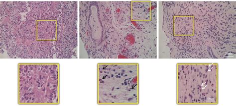 Immunohistochemical Detection Of Innate Immune Cells Using Hematoxylin