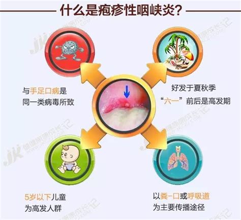 疱疹性咽峡炎高发 主要侵袭1 7岁儿童